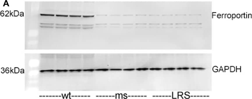 Mouse ferroportin, 5-aminolevulinic acid synthase (ALAS), and ferritin light chain (FLC) proteins are increased in sickle mice overexpressing human wt-FHC. Proteins of subcellular fractions isolated from livers of wt-, ms-, and LRS-treated mice (n = 4) were run on a western blot (30 ug protein/lane) and immunostained for (A) microsomal ferroportin.