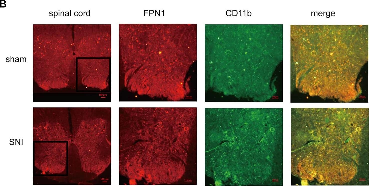 Immunocytochemistry/ Immunofluorescence: Ferroportin/SLC40A1 Antibody - BSA Free [NBP1-21502] - The cellular localization of SIRT2 & FPN1 in the spinal cord. (A) SIRT2 levels decreased in the microglia of SNI rats. (B,C) FPN1 levels decreased in the microglia & neurons of SNI rats. The image in the first column on the left shows the overall outline of the spinal cord. Representative confocal images show the results of double immunofluorescence staining of SIRT2 or FPN1 (red) in the spinal dorsal horn; CD11b, a microglia marker (green) or NeuN, a neuronal marker (green) in the sham group & SNI group. Scale bars, 100 μm. SNI, spared nerve injury; SIRT2, sirtuin 2; FPN1, ferroportin 1. Image collected & cropped by CiteAb from the following publication (//pubmed.ncbi.nlm.nih.gov/35401208), licensed under a CC-BY license. Not internally tested by Novus Biologicals.