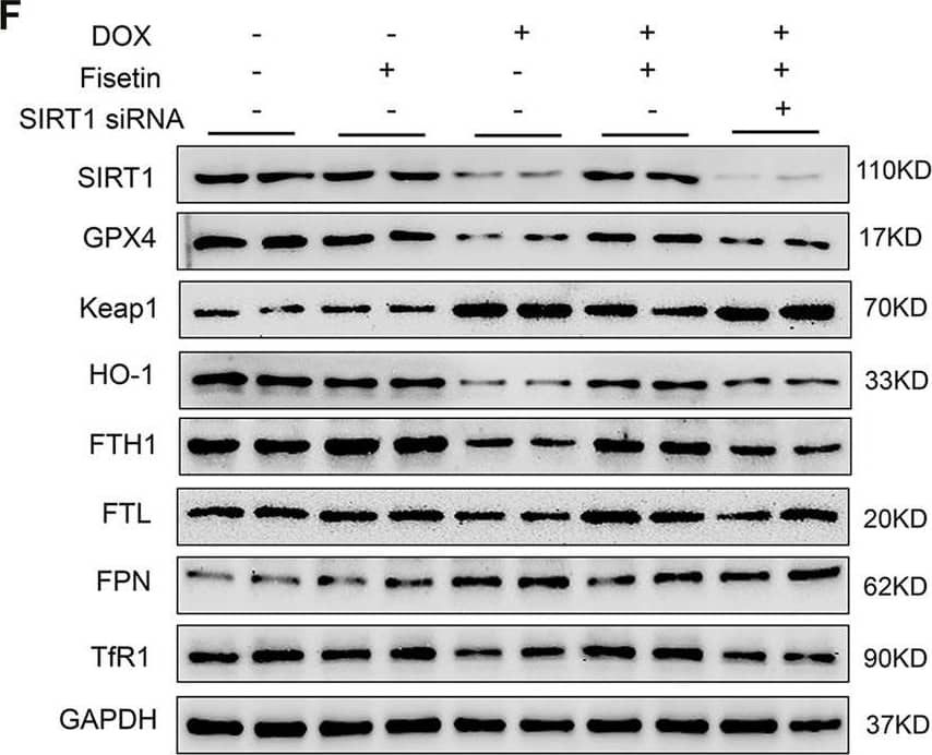 Western Blot: Ferroportin/SLC40A1 Antibody - BSA Free [NBP1-21502] - Fisetin alleviates DOX-induced ferroptosis via the SIRT1/Nrf2-regulated signaling pathway. (A & B). Western blot results of SIRT1 protein levels after SIRT1 siRNA transfection. (C). Western blot of nuclear & cytosol Nrf2 levels in vitro after treatment with DOX and/or fisetin, SIRT1 siRNA. (D–E) nucleus or cytosol Nrf2 protein from Western blot results. (F). Protein expression levels of SIRT1, GPX4, Keap1, HO-1, FTH1, FTL, FPN, TfR1, & nuclear Nrf2 in H9c2 cells administrated with DOX and/or fisetin, SIRT1 siRNA. (G). Quantification of SIRT1, GPX4, Keap1, HO-1, FTH1, FTL, FPN, & TfR1 protein from Western blot results (n = 4). The values are presented as mean ± SD. *p < 0.05; **p < 0.01; ***p < 0.001; NS, no significance. Image collected & cropped by CiteAb from the following publication (//pubmed.ncbi.nlm.nih.gov/35273493), licensed under a CC-BY license. Not internally tested by Novus Biologicals.