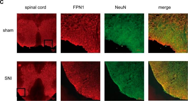 Immunocytochemistry/ Immunofluorescence: Ferroportin/SLC40A1 Antibody - BSA Free [NBP1-21502] - The cellular localization of SIRT2 & FPN1 in the spinal cord. (A) SIRT2 levels decreased in the microglia of SNI rats. (B,C) FPN1 levels decreased in the microglia & neurons of SNI rats. The image in the first column on the left shows the overall outline of the spinal cord. Representative confocal images show the results of double immunofluorescence staining of SIRT2 or FPN1 (red) in the spinal dorsal horn; CD11b, a microglia marker (green) or NeuN, a neuronal marker (green) in the sham group & SNI group. Scale bars, 100 μm. SNI, spared nerve injury; SIRT2, sirtuin 2; FPN1, ferroportin 1. Image collected & cropped by CiteAb from the following publication (//pubmed.ncbi.nlm.nih.gov/35401208), licensed under a CC-BY license. Not internally tested by Novus Biologicals.