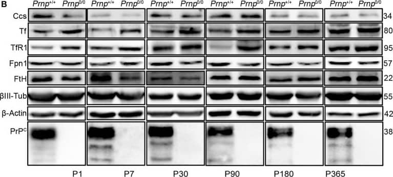 Western Blot: Ferroportin/SLC40A1 Antibody - BSA Free [NBP1-21502] - Analysis of Cu & Fe content & metal-binding protein expression in wild-type & PrPC-null mouse total brain at different ages. (A) The graph shows the ratio of Cu & Fe levels in Prnp0/0 & Prnp+/+ brain samples (P1, P365 N = 4; P7, P30, P180 N = 6; P90 N = 5). (B) Representative Western blot images showing metal-binding protein levels in Prnp0/0 & Prnp+/+ brain samples (N = 4). The constant level of the housekeeping proteins ( beta -III Tubulin &  beta -Actin) are also reported. (C) The graph shows the up- or down-regulation of protein expression in Prnp0/0 samples compared to Prnp+/+, i.e., (Prnp0/0 protein OD/housekeeping OD)/(Prnp+/+ protein OD/housekeeping OD). All error bars indicate SD; N = 4 minimum; *p < 0.05; **p < 0.01; ***p < 0.001. Image collected & cropped by CiteAb from the following publication (//pubmed.ncbi.nlm.nih.gov/27729845), licensed under a CC-BY license. Not internally tested by Novus Biologicals.