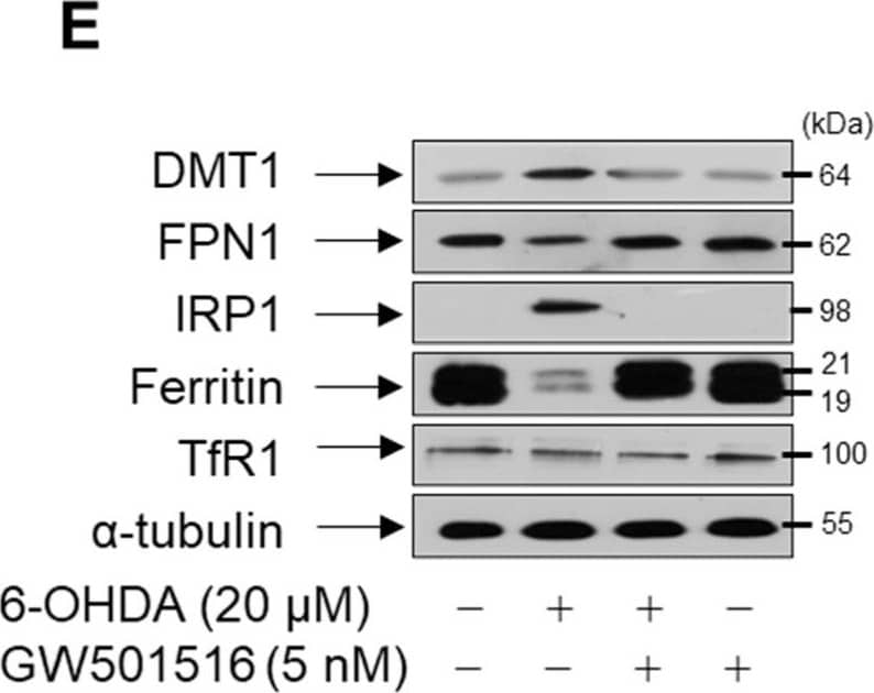 Western Blot: Ferroportin/SLC40A1 Antibody - BSA Free [NBP1-21502] - GW501516 PPARδ activation suppresses 6-OHDA-induced expression of IRP1 in SH-SY5Y cells. (A,B) Cells were treated with 6-OHDA (A) or GW501516 (B) for the indicated durations. (C) Cells stably expressing shRNA targeting scrambled sequences or PPARδ were pretreated with DMSO or GW501516 for 8 h & subsequently incubated in the presence or absence of 6-ODHA for 16 h. (D,E) Cells pretreated with DMSO or GW501516 for 8 h were incubated with or without 6-ODHA for 16 h. Total RNA & protein were extracted, & levels of mRNA & protein were analyzed by real-time PCR (A–D) & Western blot (E). The immunoblots are separate from those shown in Figure 4C,F. RPS18 &  alpha -tubulin were used as internal controls for real-time PCR & Western blot, respectively. Results are expressed as means of triplicate ± SE (A–D). * p < 0.05, ** p < 0.01 relative to untreated group; #p < 0.05 relative to 6-OHDA-treated group. Image collected & cropped by CiteAb from the following publication (//pubmed.ncbi.nlm.nih.gov/35624674), licensed under a CC-BY license. Not internally tested by Novus Biologicals.