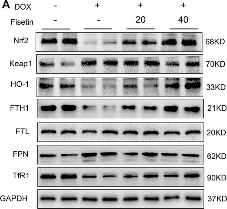 Western Blot: Ferroportin/SLC40A1 Antibody - BSA Free [NBP1-21502] - Fisetin protects against DOX-induced ferroptosis via regulating Nrf2 in rats. (A). Western blot results of Nrf2 & Keap1, HO-1, FTH1, FTL, FPN, & TfR1 protein in control & different drug-treated rat heart tissues. (B). Quantification of (A). (C). Expression of Nrf2 was detected by immunohistochemistry (IHC) (Representative images, 200X & 400X, Scale bar = 100 & 50 μm, n = 6 rats per groups) in cardiac tissue of each group. The values are presented as mean ± SD. *p < 0.05; **p < 0.01; ***p < 0.001; NS, no significance; DOX, doxorubicin. Nrf2, nuclear factor erythroid 2-related factor 2; Keap1, Kelch-like ECH-associated protein 1; HO-1, heme oxygenase-1; FTH1, ferritin heavy chain 1; FTL, ferritin light chain; FPN, ferroportin; TfR1, transferrin receptor 1. Image collected & cropped by CiteAb from the following publication (//pubmed.ncbi.nlm.nih.gov/35273493), licensed under a CC-BY license. Not internally tested by Novus Biologicals.