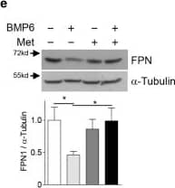 Western Blot: Ferroportin/SLC40A1 Antibody - BSA Free [NBP1-21502] - Metformin rescues BMP6-mediated alteration of iron metabolism in mice.(a–e) C57/BL6 mice (n = 4 per group) were treated with BMP6 (500 μg/kg, i.p.) & metformin (200 mg/kg, p.o.). (a) Serum iron level. (b) Q-PCR analysis showing hepcidin & SHP mRNA levels in liver. (c) Serum hepcidin levels. (d) Western blot analysis showing SMAD1/5/8 phosphorylation & FPN in liver. (e) Western blot analysis (top) & graphical representation (bottom) showing FPN expression in spleen. (f) Schematic diagram of SHP-mediated inhibition of BMP6-SMADs pathway. Data are presented as means ± SD. Arrows show locations of molecular weight markers. The western blot images were cropped with a grey cropping line. All gels for western blot analysis were run under the same experimental conditions. *P < 0.05, **P < 0.01, ***P < 0.001 by two-tailed Student t-test. Image collected & cropped by CiteAb from the following publication (//www.nature.com/articles/srep34630), licensed under a CC-BY license. Not internally tested by Novus Biologicals.