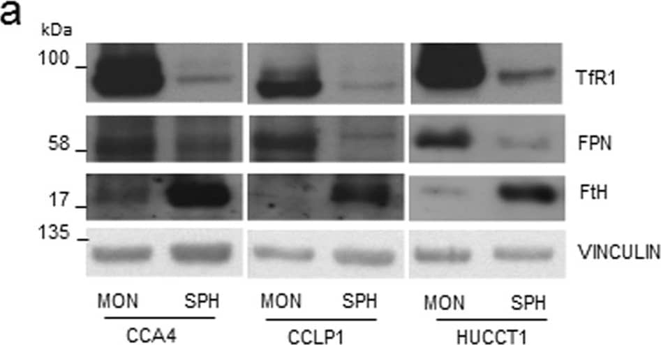 Western Blot: Ferroportin/SLC40A1 Antibody - BSA Free [NBP1-21502] - Differential expression of proteins of iron metabolism in CCA cells. The CCA4, CCLP1 & HUCCT1 human CCA-derived cell lines were cultured as adherent monolayers (MON) or in 3D sphere conditions (SPH). Panel a. Top left, representative immunoblot analysis. Cell extracts were reacted with antibodies against transferrin receptor (TfR1), ferroportin (FPN), ferritin H subunit (FtH) & vinculin. Cropped blots are displayed. The original full blot images can be found in Supplementary Information. The graphs show densitometric quantification of immunoblot analyses. The values were normalized to vinculin & expressed as a fraction of respective MON cells normalized to 1. Mean values ± SEM (n = 6), *p ≤ 0.05, **p ≤ 0.01 vs control MON for each cell line. Panel b. RNA bandshift analysis of IRP activity. Cytoplasmic extracts were incubated with a 32P-labeled iron-responsive element (IRE) probe & RNA-protein complexes separated on non-denaturing polyacrylamide gels. On the left a representative autoradiogram is shown. A cropped gel is displayed. The original full gel image can be found in Supplementary Information. The graph on the right shows the densitometric quantification of IRPs bands by direct nuclear counting, as described in Materials & Methods; mean percentages ± SEM of control values (n = 6),, **p ≤ 0.01, ***p< 0.001 vs control MON for each cell line. Panel c. TfR1 & FPN mRNA levels were measured by quantitative RT-PCR. Samples were analyzed in triplicate, normalized to the housekeeping gene 18 S & expressed as percentage of respective MON cells normalized to 1. Mean values ± SEM (n = 6), **p ≤ 0.01 vs control MON for each cell line. Image collected & cropped by CiteAb from the following publication (//pubmed.ncbi.nlm.nih.gov/29247214), licensed under a CC-BY license. Not internally tested by Novus Biologicals.