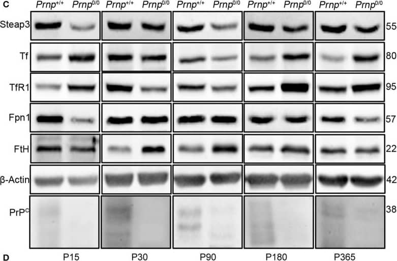 Western Blot: Ferroportin/SLC40A1 Antibody - BSA Free [NBP1-21502] - Comparison of Cu, Fe, & metal-binding protein expression levels in wild-type & PrPC-null mouse spleen at different ages. (A) The graph shows the ratio of Cu & Fe levels in Prnp0/0 & Prnp+/+ spleen samples (P15 N = 3; P30 N = 4; P90, P180 N = 6; P365 N = 5). (B) The graph shows the weight of spleen extracted from Prnp0/0 & Prnp+/+ mice; N = 4. (C) Representative Western blot images showing metal-binding protein levels in Prnp0/0 & Prnp+/+ spleen samples. The constant level of the housekeeping protein ( beta -Actin) are also reported. (D) The graph shows the up- or down-regulation of protein expression in Prnp0/0 samples compared to Prnp+/+, i.e., (Prnp0/0 protein OD/housekeeping OD)/ (Prnp+/+ protein OD/housekeeping OD); N = 4. All error bars indicate SD; *p < 0.05; **p < 0.01; ***p < 0.001. Image collected & cropped by CiteAb from the following publication (//pubmed.ncbi.nlm.nih.gov/27729845), licensed under a CC-BY license. Not internally tested by Novus Biologicals.