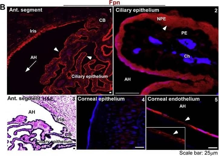 Immunocytochemistry/ Immunofluorescence: Ferroportin/SLC40A1 Antibody - BSA Free [NBP1-21502] - Distribution of TfR & Fpn in the anterior segment of bovine eye:(A) The reaction for TfR is evident on the ciliary epithelium facing the AH (panel 1). TfR is localized on the apical membrane & intracellular vesicles of NPE cells as in the human sample (panel 2). The corneal epithelium does not react for TfR (panel 3), while the corneal endothelium shows a distinct reaction on the plasma membrane (panel 4). H&E staining shows multiple layers of corneal epithelium, the stroma, & a single layer of corneal endothelium (panel 5). Scale bar: 25 μm. (B) Fpn is expressed on the ciliary epithelium & the iris (panel 1). The expression of Fpn is limited to NPE cells as in the human sample (panel 2). H&E staining shows the orientation of ciliary epithelium with respect to the iris & AH (panel 3). Unlike human samples, the bovine corneal epithelium did not react for Fpn (panel 4). However, corneal endothelium showed strong reactivity for Fpn (panel 5). Scale bar: 25 μm. Image collected & cropped by CiteAb from the following publication (//pubmed.ncbi.nlm.nih.gov/29859760), licensed under a CC-BY license. Not internally tested by Novus Biologicals.