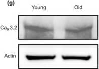 Western Blot: Cav3.2 Antibody (S55/10) [NBP1-22444] - Age attenuates the role of CaV3.2 channels in Ca2+ spark generation & decreases CaV3.2 protein expression in VSMC. (a), Ca2+ fluorescence images of a Fluo‐4‐AM–loaded VSMC from a young mouse & time course of Ca2+ fluorescence changes in the cellular ROI (upper panel). Cell boundary is marked with dashed line. (b), same as (a) but in the presence of Ni2+ (50 µM). (c), same as (a) but in a VSMC from an old mouse. (d), same as (c) but in the presence of Ni2+ (50 µM). (e, f), summary of the results. Ca2+ spark frequency (e) & fraction of cells producing Ca2+ sparks (f) in VSMCs from young mice (n = 102), in VSMCs from young mice cells incubated with Ni2+ (n = 85), in VSMCs from aged mice (n = 129), & in VSMCs from aged mice cells incubated with Ni2+ (n = 127). Cells were isolated from 4 mice in each group; 25–40 cells were recorded & analyzed from each mouse. VSMC, vascular smooth muscle cell. (g), Western blot analysis of CaV3.2 proteins in mesenteric arteries of young versus old mice. (h), quantification of Western blot results. Mesenteric arteries were taken from 9 mice in each group. *, p < .05. n.s., not significant Image collected & cropped by CiteAb from the following publication (//pubmed.ncbi.nlm.nih.gov/32187825), licensed under a CC-BY license. Not internally tested by Novus Biologicals.