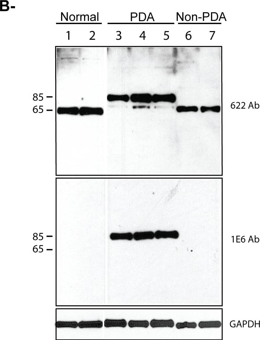 Western Blot: Palladin Antibody (1E6) [NBP1-25959] - Analysis of human palladin isoforms in pancreatic tissues.A. Human palladin isoforms. Proline-rich domains are represented by red boxes, & Ig-like domains are shown as blue boxes. The epitope recognized by the 1E6 & 4D10 antibodies is highlighted in green. The region amplified by RT-qPCR is highlighted in light blue. Isoform #1, 3 & 4 are the primary products of the palladin gene & have been detected by immunoblotting. The sequences of these isoforms are published. The sequences of isoforms #2, 5, 6, & 7 were obtained from genomic databases. “ND”: not-determined. B. Western blot analysis of pancreas samples. Small pieces of fresh tissue were snap-frozen in liquid nitrogen, ground in a chilled mortar & pestle, extracted in a detergent-containing lysis buffer, & centrifuged at 15,000×g to remove any unsolubilized particulates. The supernatant was boiled in Laemmli sample buffer & resolved by SDS-PAGE, with 15 µg protein loaded per lane. The samples were immunoblotted & probed with two anti-palladin antibodies & an antibody to GADPH (a housekeeping gene) as a control for equal loading. Lanes 1–2: normal pancreas. Lanes 3–5: primary adenocarcinoma tumors (PDA). Lane 6–7: Non-primary adenocarcinoma tumors (Non-PDA) (Lane 6: solid pseudopapillary tumor, Lane 7: neuroendocrine tumor). C. RT-qPCR. Total RNA was isolated from normal tissue (patients 1–4) & PDA tumors (patients 1–3), reverse transcribed, & subjected to RT-qPCR using gene-specific primers. Each bar represents the mean + SEM (0.06–0.35%) from three or more independent determinations. Image collected & cropped by CiteAb from the following publication (//dx.plos.org/10.1371/journal.pone.0010347), licensed under a CC-BY license. Not internally tested by Novus Biologicals.