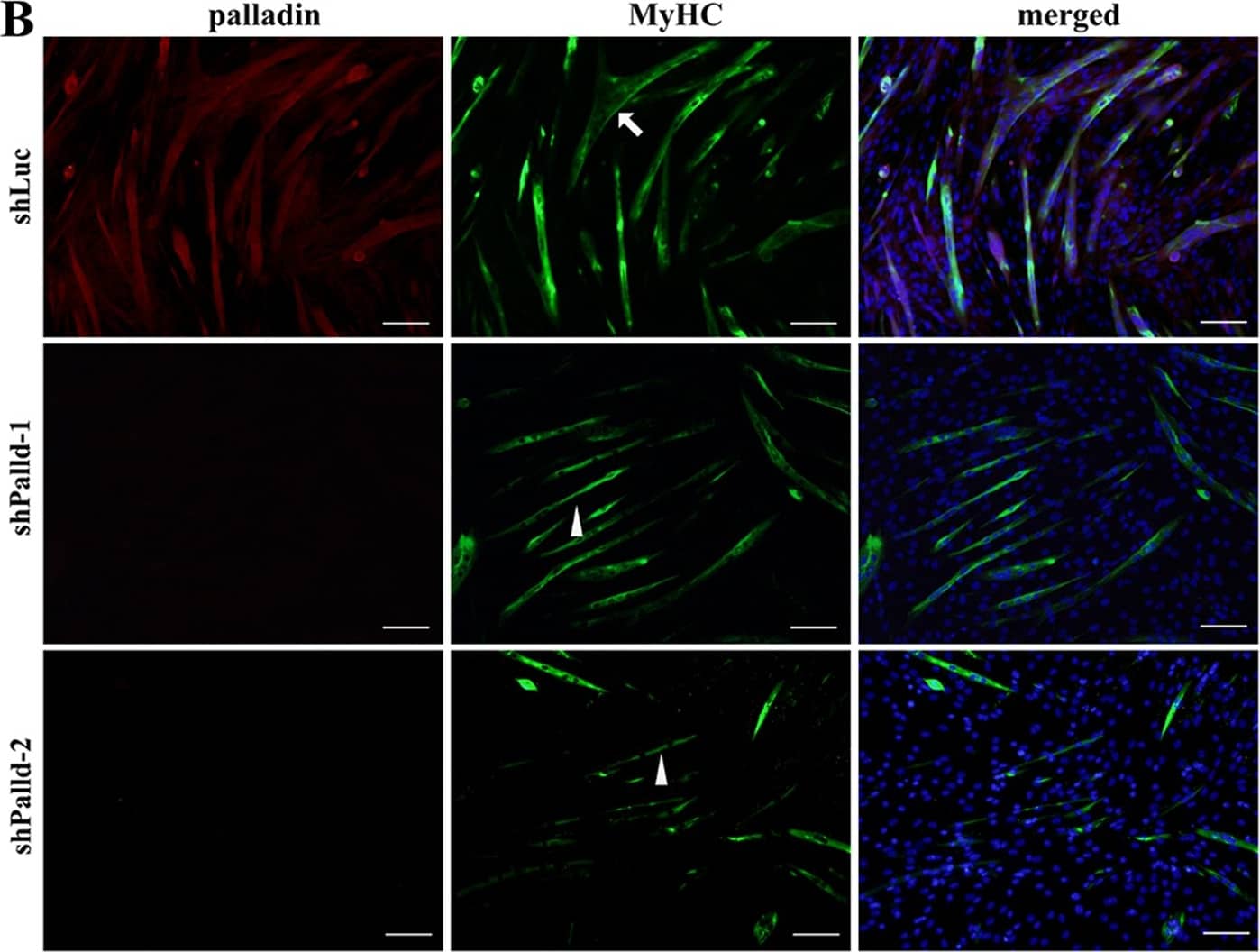 Immunocytochemistry/ Immunofluorescence: Palladin Antibody (1E6) [NBP1-25959] - Effect of palladin depletion on terminal differentiation of C2C12 cells.(A) Phase contrast images of stable transfectants at late stages of differentiation. Scale bar is 50 μm. (B) Representative immunofluorescence images of stable transfectants at day 5 of differentiation. Cells were labeled with palladin (red), MyHC (green), & DAPI (blue). Scale bar is 100 μm. (C) Fusion index analysis of stable transfectants at day 5 (left) & day 7 (right) of differentiation. A minimum of 4,000 nuclei were counted from random fields of each cell line. Note that palladin depletion resulted in a decrease of the fusion index at the late stage of differentiation. (D) Quantification of multinucleated myotubes throughout the course of differentiation. (E) Quantification of the number of MyHC-positive cells in stable transfectants. All error bars indicate the means ± SD of at least four independent experiments. * indicates statistically significant difference from control cells, * p<0.05, ** p<0.01, *** p<0.001 by Student’s t-test. ns = not significant. Image collected & cropped by CiteAb from the following publication (//pubmed.ncbi.nlm.nih.gov/25875253), licensed under a CC-BY license. Not internally tested by Novus Biologicals.