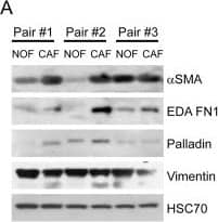 Western Blot: Palladin Antibody (1E6) [NBP1-25959] - CAFs & NOFs are biochemically & morphologically different & CAF exosomes can also be transferred to CRC cells(A) Western blot of paired primary NOFs & CAFs for myofibroblastic markers alpha-smooth muscle actin ( alpha -SMA), fibronectin ED-A (ED-A FN1), palladin & vimentin. HSC-70 was used as an equal loading control. (B) Light microscopy of representative primary NOF & CAF cells (10x). (C) Fluorescence microscopy demonstrating phalloidin staining of F-actin filaments (green), counterstained with DAPI (blue; 40x). (D) Mean surface area & (E) intensity of phalloidin staining in a representative NOF-CAF pair. (F) Flow cytometry of DLD1 cells (control) & DLD1 cells co-cultured with CAF exosomes (exosome). The proportion of cells under the M1 region is given as a percentage. (G) Co-culture of CAF exosomes with DLD1 & SW480 cells with resultant increase in miR-199b & miR-21-5p. Data is presented as mean +/− SEM. Student's t-test (D, E) or paired t-test (F, G): *p<0.05, **p<0.01, ***p<0.001. Image collected & cropped by CiteAb from the following publication (//pubmed.ncbi.nlm.nih.gov/29283887), licensed under a CC-BY license. Not internally tested by Novus Biologicals.