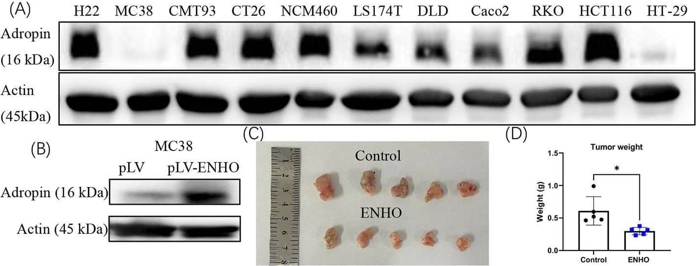 Ectopic adropin expression inhibits tumor growth in vivo. (A) Presence of adropin in the indicated cell lines. (B) Ectopic adropin expression in MC38 cells by lentivirus transfection. (C) In vivo tumors formed by MC38 and MC38-ENHO cells. (D) Weights of tumors. Detection of macrophages (E) and CD8+ T cells (F) in tumors. (G) Phenotypic analysis of tumor-infiltrated macrophages. The experiment was repeated twice. ns, no significance; *, P < 0.05; **, P < 0.01; ***, P < 0.001 Image collected and cropped by CiteAb from the following open publication (//pubmed.ncbi.nlm.nih.gov/37904094), licensed under a CC-BY license. Not internally tested by Novus Biologicals.