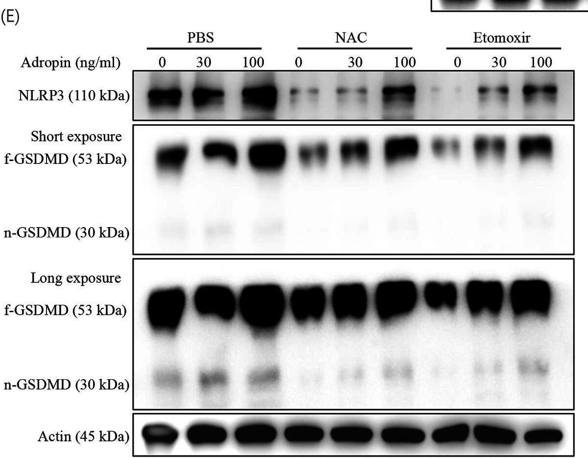 Metabolic molecules in macrophage with adropin treatment. (A) Variations of key molecules involved in glycol–lipid metabolism. (B) Akt, mTOR, and AMPK levels of adropin-treated macrophages. (C) Detection of the above metabolism molecules in ENHO−/− macrophages. (D) Akt, mTOR, and AMPK levels of ENHO−/− macrophages. (E) Effect of ROS depletion or CPT1 alpha  inhibition on inflammasome activation. Each experiment was repeated at least twice Image collected and cropped by CiteAb from the following open publication (//pubmed.ncbi.nlm.nih.gov/37904094), licensed under a CC-BY license. Not internally tested by Novus Biologicals.
