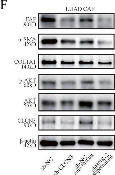  HNRNPK/CLCN3 axis facilitated LUAD progression through interaction between tumor cells and CAFs. (a) Primary human CAFs and paired NFs were extracted from fresh LUAD samples. The expression of CAF markers was increased in CAFs compared to NFs, which was in accord with the typical characteristic of CAFs. (b) The levels of CLCN3 were detected in the culture supernatants of LUAD cells, and the data indicated that decreased extracellular CLCN3 secretion could be induced by HNRNPK knockdown. (c-e) The supernatants (HNRNPK knockdown and control) of LUAD cells were incubated with CAFs for 24 h. We confirmed that the PI3K-AKT signaling pathway was significantly enriched in CAFs. (f) The levels of p-AKT,  alpha -SMA, FAP, and COL1A1 were decreased when CAFs were stimulated with the supernatants of HNRNPK-knockdown cells. After CLCN3 knockdown in CAFs, the levels of p-AKT,  alpha -SMA, FAP, and COL1A1 were also effectively inhibited. (g) Due to the activation inhibition, the CAFs co-cultured with HNRNPK-knockdown LUAD cells were then considered as inhibited CAFs. The analysis by ELISA revealed that the TGF-beta 1 production of inhibited CAFs was significantly decreased (n = 7). (h) The supernatants of inhibited CAFs attenuated the expression of HNRNPK protein in the H1299 nucleus, and the attenuation effect was reversed after TGF-beta 1 treatment. (i) The supernatants of inhibited CAFs attenuated the fluorescence intensity of HNRNPK in the H1299 nucleus, which was also reversed after the addition of exogenous TGF-beta 1. (j, k) The supernatants of inhibited CAFs markedly attenuated the clonogenicity and invasion of LUAD cells, and this phenomenon was further reversed after the addition of TGF-beta 1 (n = 3). *P < 0.05. Image collected and cropped by CiteAb from the following open publication (//pubmed.ncbi.nlm.nih.gov/36439880), licensed under a CC-BY license. Not internally tested by Novus Biologicals.