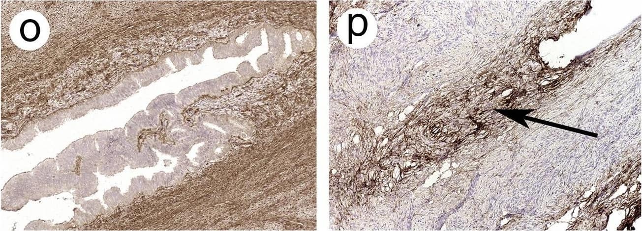 Immunohistochemistry: Collagen IV Antibody [NBP1-26549] - Photographs showing H&E staining & immunostaining for Col-I, Col-III, Col-IV & Col-V in the rhesus macaque & baboon intramural tube. Images of open fallopian tube (a, c, e, g, i, k, m, o, q & s) were obtained from control animals. Occluded tube (b, d, f, h, j, l, n, p, r & t) were from animals treated with 5% PF. Arrows indicate fibrotic response. All images were captured at original magnification ×200. Insets (frame r & s) show negative control with an irrelevant antibody. Treatment with PF increased collagen immunoreactivity in the lamina propria of the intramural tube. Image collected & cropped by CiteAb from the following publication (//linkinghub.elsevier.com/retrieve/pii/S0010782416301445), licensed under a CC-BY license. Not internally tested by Novus Biologicals.