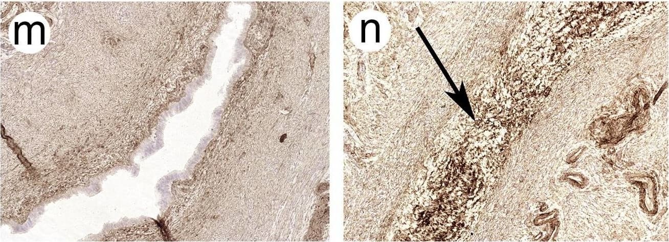 Immunohistochemistry: Collagen IV Antibody [NBP1-26549] - Photographs showing H&E staining & immunostaining for Col-I, Col-III, Col-IV & Col-V in the rhesus macaque & baboon intramural tube. Images of open fallopian tube (a, c, e, g, i, k, m, o, q & s) were obtained from control animals. Occluded tube (b, d, f, h, j, l, n, p, r & t) were from animals treated with 5% PF. Arrows indicate fibrotic response. All images were captured at original magnification ×200. Insets (frame r & s) show negative control with an irrelevant antibody. Treatment with PF increased collagen immunoreactivity in the lamina propria of the intramural tube. Image collected & cropped by CiteAb from the following publication (//linkinghub.elsevier.com/retrieve/pii/S0010782416301445), licensed under a CC-BY license. Not internally tested by Novus Biologicals.