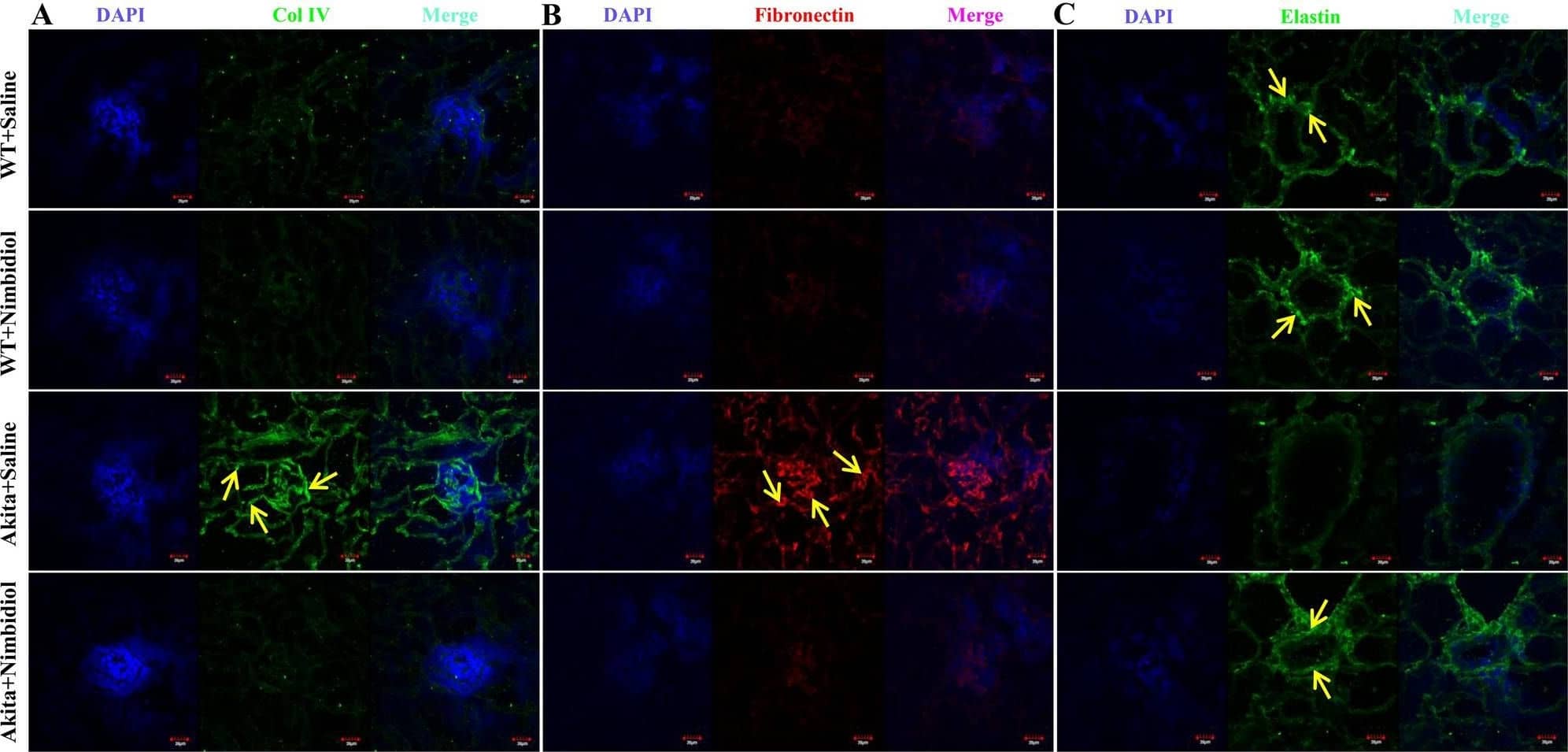 Nimbidiol inhibited upregulation of collagen IV and fibronectin, and downregulation of elastin expression in the diabetic kidney. Representative immunofluorescence images of the renal cortex showing expression of (A) Col IV, (B) fibronectin and (C) elastin. The nuclear counterstaining was performed using DAPI (blue). The bar diagrams represent the fold change in the fluorescence intensity from WT + Saline for (D) Col IV (E) fibronectin and (F) elastin. Data are mean +/- SD (n = 6/group). *p < 0.05 versus WT + Saline, WT + Nimbidiol and Akita + Nimbidiol, †p < 0.05 versus Akita + Saline. Scale bar: 20 um; magnification × 60. Image collected and cropped by CiteAb from the following open publication (//pubmed.ncbi.nlm.nih.gov/36522378), licensed under a CC-BY license. Not internally tested by Novus Biologicals.