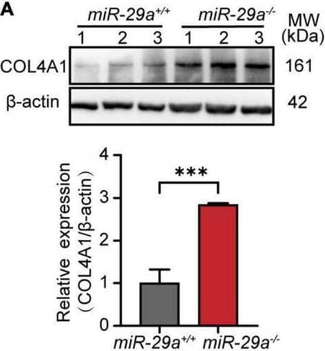 MiR-29a regulation of target gene expression in cochlea from miR-29a+/+ and miR-29a–/– mice. (A–G) With  beta -actin as a control, COL4A1, COL4A2, COL4A3, COL4A4, COL4A5, LAMB2, and LAMC1 protein levels in cochlea were analyzed by Western blot. The independent t-test was used to compare data between two groups [COL4A1, t(4) = 9.920, P < 0.001; COL4A2, t(4) = 3.847, P = 0.018; COL4A3, t(4) = 3.389, P = 0.028; COL4A4, t(4) = 2.842, P = 0.047; COL4A5, t(4) = 3.782, P = 0.019; LAMB2, t(4) = 3.915, P = 0.017; LAMC1, t(4) = 3.088, P = 0.037]. (H) The mRNA expression levels of target genes as measured by qRT-PCR [independent t-test, Col4a1, t(4) = 6.050, P = 0.004; Col4a2, t(4) = 13.145, P < 0.001; Col4a3, t(4) = 3.735, P = 0.02; Col4a4, t(4) = 7.238, P = 0.002; Col4a5, t(4) = 13.141, P < 0.001; Lamb2, t(4) = 8.529, P = 0.001; Lamc1, t(4) = 3.126, P = 0.035]. All data are shown as the mean +/- SD, n = 3 biological replicates, *P < 0.05, **P < 0.01, and ***P < 0.001 between two groups. Image collected and cropped by CiteAb from the following open publication (//pubmed.ncbi.nlm.nih.gov/37275774), licensed under a CC-BY license. Not internally tested by Novus Biologicals.