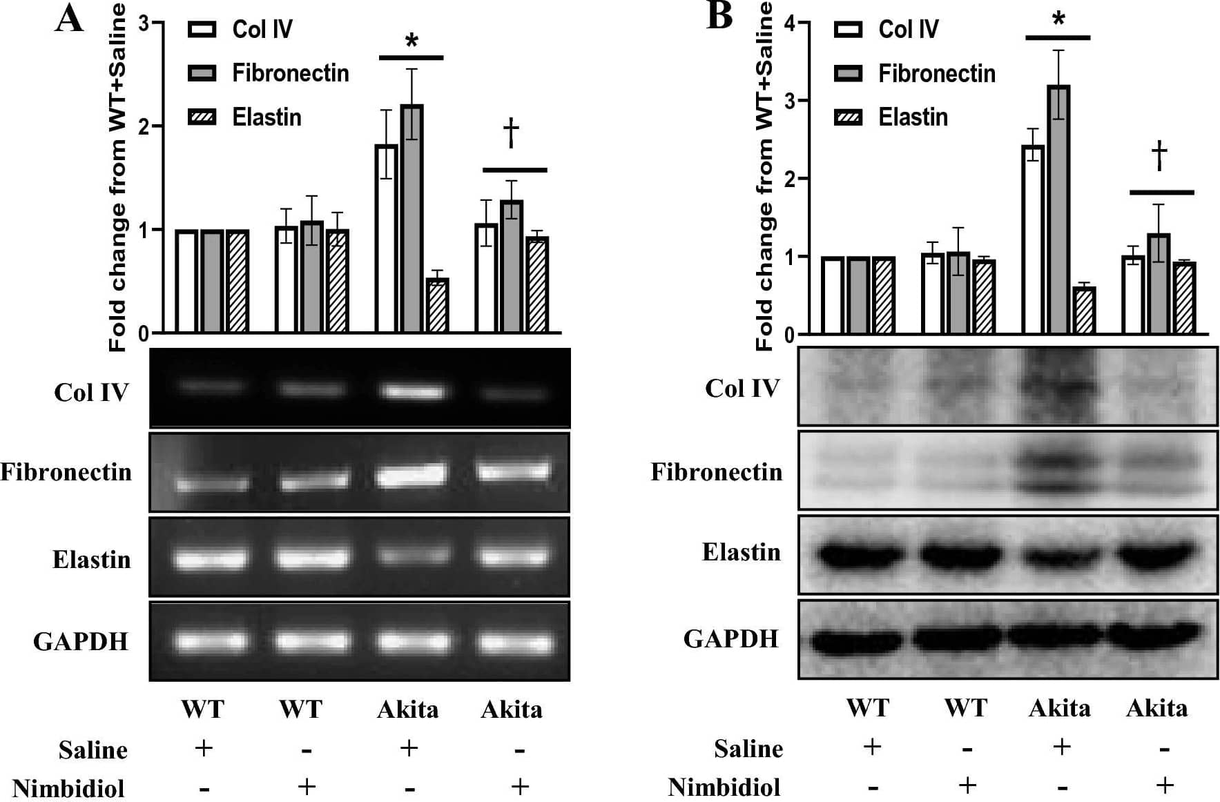 Nimbidiol treatment normalized the expression of collagen IV, fibronectin and elastin in the diabetic kidney. Representative images from (A) Semi-quantitative RT-PCR analyses showing gene expression and (B) western blot analyses showing protein expression of Col IV, fibronectin and elastin in the kidney. The bar diagrams represent the fold change from WT + Saline. Data are mean +/- SD (n = 6/group). *p < 0.05 versus WT + Saline, WT + Nimbidiol and Akita + Nimbidiol, †p < 0.05 versus Akita + Saline. Image collected and cropped by CiteAb from the following open publication (//pubmed.ncbi.nlm.nih.gov/36522378), licensed under a CC-BY license. Not internally tested by Novus Biologicals.