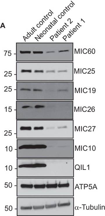 Western Blot APOO Antibody (2F1)