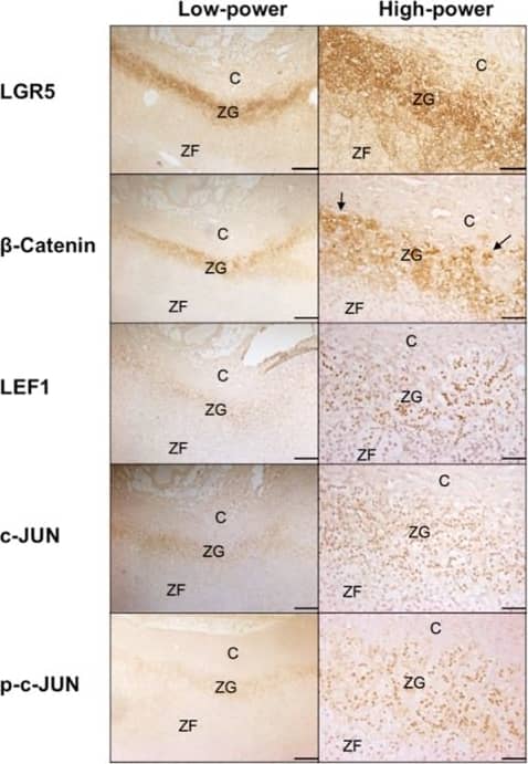 Immunohistochemistry-Paraffin: Lgr5/GPR49 Antibody - BSA Free [NBP1-28904] - Wnt-related genes show selective expression in the ZG of human adrenal. A, Heat map of 37 genes (shown on the vertical axis), which are 5-fold or greater differentially expressed in ZG & ZF. Genes previously associated with the Wnt signaling pathway are highlighted in red. On the horizontal axis, each pair of ZG & ZF from the 20 adrenals are anonymized & numbered. Probe set & detailed microarray information are available from the National Center for Biotechnology Information Gene Expression Omnibus under accession number GSE64957. B, IHC localization of LGR5 & downstream Wnt signaling proteins in the ZG: from the canonical  beta -catenin pathway,  beta -catenin & LEF1, & from the noncanonical AP1/JUN pathway, c-JUN & p-c-JUN. IHC was performed on formalin-fixed, paraffin-embedded human adrenal sections (4 μm) using a chromogen-based detection system (3,3'-Diaminobenzidine), which results in a positive brown staining. Interestingly,  beta -catenin staining was mostly membranous or cytoplasmic (rather than nuclear staining as highlighted by the arrows), indicating limited canonical Wnt activation. Pictures are representative of six normal adrenal sections that were used in our microarray study; four from primary hyperaldosteronism patients & two from pheochromocytoma patients. Scale bar, 500 μm (low power) & 100 μm (high power). C, capsule. Image collected & cropped by CiteAb from the following publication (//academic.oup.com/jcem/article-lookup/doi/10.1210/jc.2015-1734), licensed under a CC-BY license. Not internally tested by Novus Biologicals.