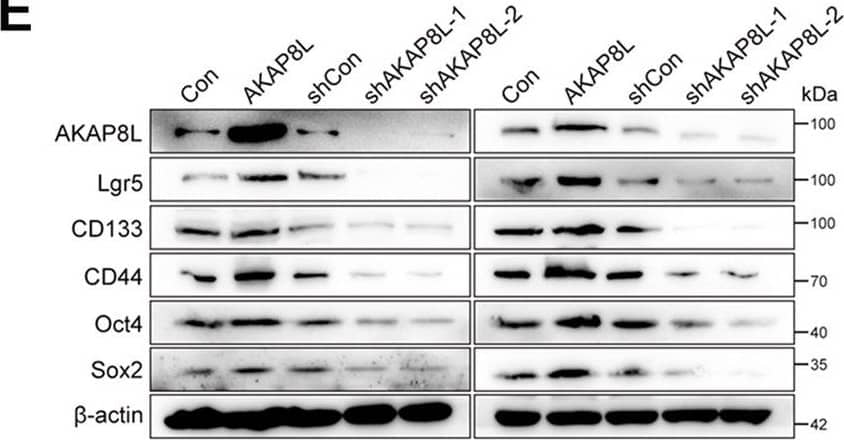 AKAP8L enhances the stemness in GC cells.A Western blot analysis showed ectopic expression of AKAP8L in GC cells transfected with AKAP8L (AKAP8L) or control lentivirus (Con), and AKAP8L silencing in cells treated with scrambled shRNA (shCon) or shRNA against AKAP8L (shAKAP8L-1, shAKAP8L-2). B Representative images and quantification analysis of spheroids in AKAP8L overexpression or the control groups, and AKAP8L knockdown or the control groups. Scale bar indicates 50 μm. C In soft agar colony formation assay, representative images and numbers of spheroids formed by AKAP8L-overexpressing and AKAP8L-knockdown BGC-823/Oxa and MKN-45/Oxa. Scale bar indicates 50 μm. D, E qPCR and Western blot assays showed the expression of stem cell markers induced by AKAP8L or AKAP8L shRNAs. The values indicate the mean +/- standard deviation (SD) of three independent experiments. *P < 0.05, **P < 0.01,***P < 0.001. Image collected and cropped by CiteAb from the following open publication (//pubmed.ncbi.nlm.nih.gov/36522343), licensed under a CC-BY license. Not internally tested by Novus Biologicals.