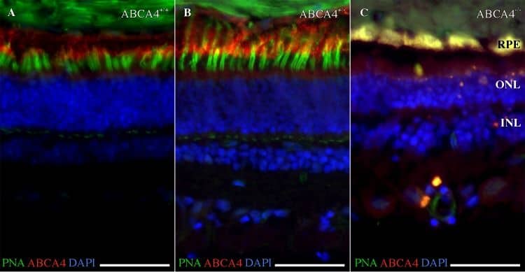 Immunocytochemistry/ Immunofluorescence: ABCA4 Antibody (3F4) [NBP1-30032] - Fluorescence histochemistry of ABCA4, cone photoreceptors, & autofluorescence in the canine retina.(A-C) Fluorescence micrographs showing ABCA4 expression (red), FITC-conjugated peanut agglutinin (PNA, green), & DAPI nuclear staining (blue) in wild-type (ABCA4+/+), heterozygous (ABCA4+/-), & affected (ABCA4-/-) retinas. PNA labels cone photoreceptors. Autofluorescence, indicative of lipofuscin accumulation, was seen in the ABCA4-/- RPE. (D) Bar graph with the average number of DAPI-stained nuclei within a given region of the ONL & the INL. (E-G) Fluorescence micrographs of RPE without immunohistochemistry show autofluorescence. (H) Bar graph with background-corrected mean autofluorescence-intensity in the RPE. Note the reduction of ABCA4-immunoreactivity & PNA binding, higher autofluorescence, & fewer nuclei in the ONL in the ABCA4-/- compared to ABCA4+/+ or ABCA4+/- retinas. All scale bars = 50 μm; RPE = retinal pigment epithelium; ONL = outer nuclear layer; INL = inner nuclear layer; Because there was only one individual per genotype, the statistics are valid for the technical replicates. ANOVA with Tukey’s post hoc test, n = 6; **P < 0.01; ***P < 0.001; mean ± S.D. Image collected & cropped by CiteAb from the following publication (//pubmed.ncbi.nlm.nih.gov/30889179), licensed under a CC-BY license. Not internally tested by Novus Biologicals.