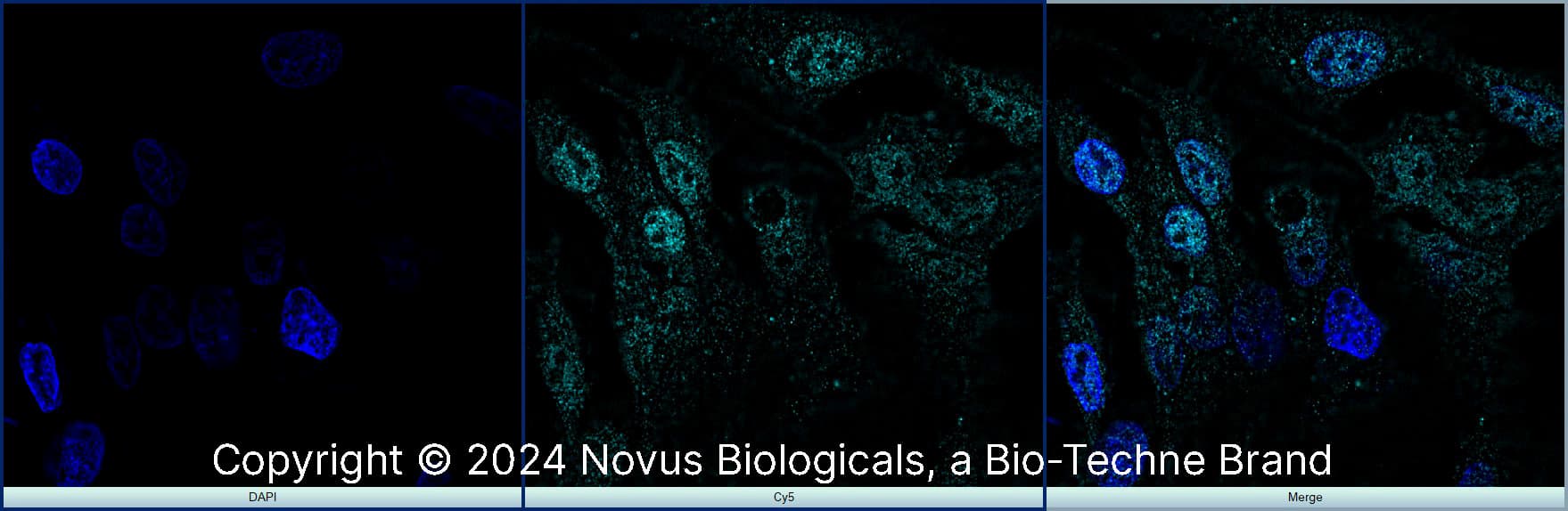 Prox1 (5G10) was detected in immersion fixed HepG2 human hepatocellular carcinoma cell line using Rat anti- Prox1 (5G10) Protein G Purified Monoclonal Antibody conjugated to Alexa Fluor® 647 (Catalog # NBP1-30045AF647) (light blue) at 10 µg/mL overnight at 4C. Cells were counterstained with DAPI (dark blue). Cells were imaged using a 100X objective and digitally deconvolved.