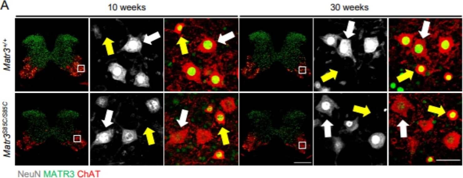 Immunocytochemistry/ Immunofluorescence: Choline Acetyltransferase/ChAT Antibody [NBP1-30052] - MATR3 loss in  alpha -motor neurons & interneurons in the cervical spinal cord of Matr3S85C/S85C mice. (A) Representative images of 10 & 30 weeks cervical spinal cord staining for  alpha -motor neurons (ChAT+, NeuN+, denoted by white arrows) &  gamma -motor neurons (ChAT+, NeuN−, denoted by yellow arrows). Scale bar for the spinal cord image denotes 500 μm & the zoomed-in image denotes 50 µm. Quantification of the percentage of motor neurons with reduced MATR3 staining in (B)  alpha -motor neurons (10 weeks: n = 3 Matr3+/+, 3 Matr3S85C/S85C; 30 weeks: n = 3 Matr3+/+, 3 Matr3S85C/S85C) & (C)  gamma -motor neurons (10 weeks: n = 3 Matr3+/+, 3 Matr3S85C/S85C; 30 weeks: n = 3 Matr3+/+, 3 Matr3S85C/S85C). Quantification of the number of (D)  alpha -motor neurons (10 weeks: n = 6 Matr3+/+, 3 Matr3S85C/S85C; 30 weeks: n = 3 Matr3+/+, 3 Matr3S85C/S85C) & (E)  gamma -motor neurons (10 weeks: n = 3 Matr3+/+, 3 Matr3S85C/S85C; 30 weeks: n = 3 Matr3+/+, 3 Matr3S85C/S85C). (F) Representative images of 10 & 30 weeks PVALB+ interneurons in the cervical spinal cord. Interneurons with reduced MATR3 staining are denoted by a white asterisk. Scale bar denotes 50 µm. (G) Quantification of the percentage of PVALB+ interneurons with reduced MATR3 staining (10 weeks: n = 3 Matr3+/+, 3 Matr3S85C/S85C; 30 weeks: n = 3 Matr3+/+, 3 Matr3S85C/S85C). (H) Quantification of the number of PVALB+ interneurons (10 weeks: n = 3 Matr3+/+, 3 Matr3S85C/S85C; 30 weeks: n = 3 Matr3+/+, 3 Matr3S85C/S85C). Bar graph heights depict mean ± SEM, with each datapoint representing an animal. * p < 0.05, ** p < 0.01, *** p < 0.001, **** p < 0.0001, ns = not significant. Image collected & cropped by CiteAb from the following publication (//pubmed.ncbi.nlm.nih.gov/35205163), licensed under a CC-BY license. Not internally tested by Novus Biologicals.