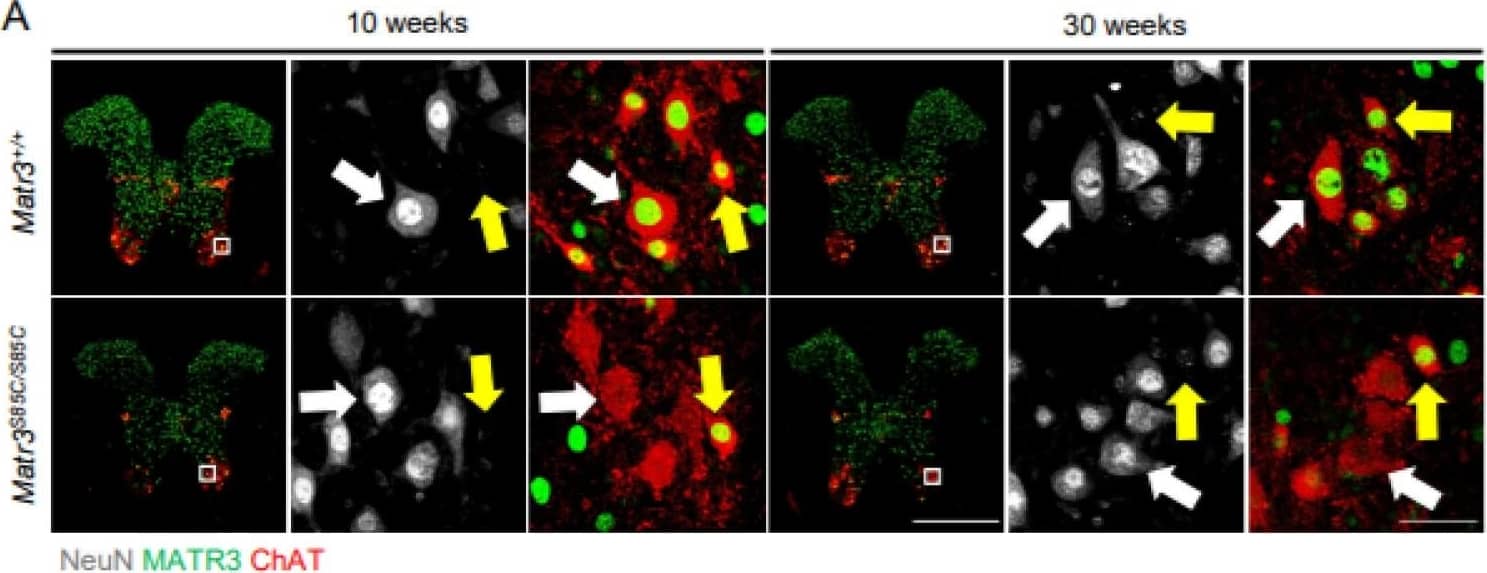 Immunocytochemistry/ Immunofluorescence: Choline Acetyltransferase/ChAT Antibody [NBP1-30052] - MATR3 loss in  alpha -motor neurons & interneurons in the thoracic spinal cord of Matr3S85C/S85C mice. (A) Representative images of 10 & 30 weeks thoracic spinal cord staining for  alpha -motor neurons (ChAT+, NeuN+, denoted by white arrows) &  gamma -motor neurons (Chat+, NeuN−, denoted by yellow arrows). Scale bar for the spinal cord image denotes 500 μm & the zoomed-in image denotes 50 µm. Quantification of the percentage of motor neurons with reduced MATR3 staining in (B)  alpha -motor neurons (10 weeks: n = 3 Matr3+/+, 3 Matr3S85C/S85C; 30 weeks: n = 3 Matr3+/+, 3 Matr3S85C/S85C) & (C)  gamma -motor neurons (10 weeks: n = 3 Matr3+/+, 3 Matr3S85C/S85C; 30 weeks: n = 3 Matr3+/+, 3 Matr3S85C/S85C). Quantification of the number of (D)  alpha -motor neurons (10 weeks: n = 3 Matr3+/+, 3 Matr3S85C/S85C; 30 weeks: n = 3 Matr3+/+, 3 Matr3S85C/S85C) & (E)  gamma -motor neurons (10 weeks: n = 3 Matr3+/+, 3 Matr3S85C/S85C; 30 weeks: n = 3 Matr3+/+, 3 Matr3S85C/S85C). (F) Representative images of 10 & 30 weeks PVALB+ interneurons in the thoracic spinal cord. Interneurons with reduced MATR3 staining are denoted by a white asterisk. Scale bar denotes 50 µm. (G) Quantification of the percentage of PVALB+ interneurons with reduced MATR3 staining (10 weeks: n = 3 Matr3+/+, 3 Matr3S85C/S85C; 30 weeks: n = 3 Matr3+/+, 3 Matr3S85C/S85C). (H) Quantification of the number of PVALB+ interneurons (10 weeks: n = 3 Matr3+/+, 3 Matr3S85C/S85C; 30 weeks: n = 3 Matr3+/+, 3 Matr3S85C/S85C). Bar graph heights depict mean ± SEM, with each datapoint representing an animal. * p < 0.05, *** p < 0.001, **** p < 0.0001, ns = not significant. Image collected & cropped by CiteAb from the following publication (//pubmed.ncbi.nlm.nih.gov/35205163), licensed under a CC-BY license. Not internally tested by Novus Biologicals.