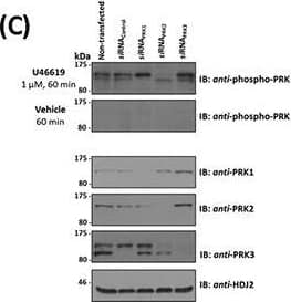 Western Blot: PKN3 Antibody [NBP1-30102] - Influence of TP Agonist on the Activation of PRK1, PRK2 & PRK3. Panel C. In order to identify the species of PRK subject to U46619-induced T-loop phosphorylation, PC-3 cells initially transfected for 72 hr with 30 nM siRNAPRK1, siRNAPRK2, siRNAPRK3 or, as controls, with a scrambled siRNAControl. Thereafter, cells serum starved & stimulated with U46619 for 60 min or with vehicle & then immunoblotted (20 μg/lane) with anti-phospho-PRK1Thr774/PRK2Thr816/PRK3Thr718 & with anti-PRK1, anti-PRK2, anti-PRK3 or, as loading controls, HDJ2 antisera, as indicated. Image collected & cropped by CiteAb from the following publication (//www.oncotarget.com/lookup/doi/10.18632/oncotarget.4664), licensed under a CC-BY license. Not internally tested by Novus Biologicals.