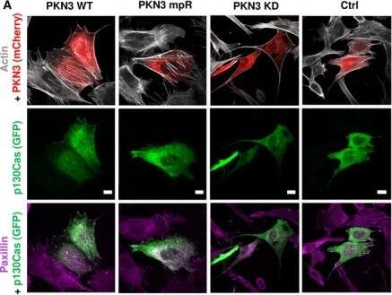 Immunocytochemistry/ Immunofluorescence: PKN3 Antibody [NBP1-30102] - PKN3 activity is important for stress fibers formation & is stimulated by the expression of p130Cas. (A) p130Cas−/−MEFs growing on FN‐coated cover slips were co‐transfected by GFP‐p130Cas & mCherry‐PKN3 fusion variant (WT, mPR, KD) or mCherry. After 48 h, cells were fixed & imaged by Leica TCS SP2 microscope (63×/1.45 oil objective). Stress fibers were visualized by Phalloidin (405) & focal adhesions by anti‐Paxillin staining (2nd 633). Representative images are shown. Scale bars represent 20 μm. (B) p130Cas−/−MEFs or p130Cas−/−MEFs re‐expressing p130Cas or transfected by GFP‐fused p130Cas variants (WT, YE, dCCH) were lysed in RIPA buffer, blotted to nitrocellulose membrane, & analyzed for endogenous PKN3 activity by antibody anti‐phosphoThr849 of PKN3 (pT849 PKN3). Expression of p130Cas mutants was verified by anti‐p130Cas antibody & loading by anti‐PKN3 & anti‐actin antibody. (C) Densitometric quantification of PKN3 activity (pT849 PKN3 phosphorylation). The effect of p130Cas re‐expression on PKN3 T849 phosphorylation was analyzed separately from the effect of transfected p130Cas mutants (indicated by a dotted line). Error bars indicate means ± SD from three independent experiments (four experiments for the left part). Statistical significance was evaluated by one‐way repeated ANOVA followed by Turkey's post hoc test (*P < 0.05; **P < 0.01). (D) Lysates or (E) immunoprecipitates (by Flag sepharose) from p130Cas−/−MEFs re‐expressing p130Cas & overexpressing PKN3 variants (WT, mPR, KD) were immunoblotted by anti‐PKN3, anti‐pT849 PKN3, & anti‐Akt antibodies (loading control). Image collected & cropped by CiteAb from the following publication (//pubmed.ncbi.nlm.nih.gov/30422386), licensed under a CC-BY license. Not internally tested by Novus Biologicals.