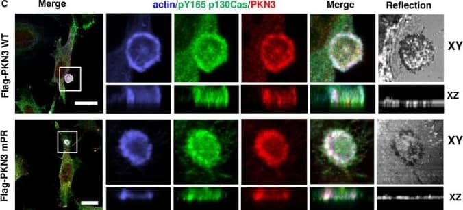 Western Blot: PKN3 Antibody [NBP1-30102] - Effect of siRNA-mediated disruption of PRK1, PRK2 & PRK3 expression on TP agonist-induced proliferation & migration of PC-3 cellsPanels A-D. PC-3 cells were transfected for 48 hr with 30 nM siRNAPRK1, siRNAPRK2, siRNAPRK3 or, as controls, with a scrambled siRNA (siRNAControl) prior to stimulation with U46619 (10 nM) or vehicle (0.0001% EtOH) for the indicated time specific to the assay, where non-transfected cells served as a reference. Panel A: For analysis of proliferation, 72 hr post-siRNA transfection PC-3 cells were stimulated for 48 hr with U46619 (10 nM) or vehicle (0.0001% EtOH). Panel B: For analysis of colony formation, 48 hr post-siRNA transfection PC-3 cells were stimulated with U46619 (10 nM) or vehicle (0.0001% EtOH) in soft agar & assessed 10 day post-treatment for colony formation. Panel C: For analysis of migration, 72 hr post-siRNA transfection PC-3 cells were stimulated for 8 hr with U46619 (10 nM) or vehicle (0.0001% EtOH). In Panels A-C, the bar charts show mean relative levels of PC-3 cell proliferation, colony formation & migration (± SEM, n ≥ 3), where levels in the vehicle-treated cells are assigned a value of 100%. The asterisks indicate where U46619-stimulation resulted in significant increases in proliferation, colony formation or migration by PC-3 cells compared to vehicle-treated cells, where ** & *** indicates p  50 measurements – 3 per cell; ***P < 0.001, one‐way ANOVA on ranks followed by Dunn's post hoc test). (C) Src‐transformed p130Cas−/−MEFs co‐expressing p130Cas (SC) & mouse Flag tagged PKN3 WT or Flag‐PKN3 mPR are shown. Cells were grown on FN‐coated coverslips for 48 h, fixed, & stained for p130Cas by anti‐pTyr165 p130Cas antibody (pY165 p130Cas; 2nd 405), for actin by Phalloidin 488 & for Flag‐PKN3 by anti‐Flag antibody (2nd 633). Reflection (670 nm) indicates fibronectin degradation. All scale bars represent 20 μm. Cell were imaged by Leica TCS SP8 microscope system equipped with Leica 63×/1.45 oil objective. Image collected & cropped by CiteAb from the following publication (//pubmed.ncbi.nlm.nih.gov/30422386), licensed under a CC-BY license. Not internally tested by Novus Biologicals.