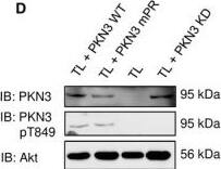 Western Blot: PKN3 Antibody [NBP1-30102] - PKN3 activity is important for stress fibers formation & is stimulated by the expression of p130Cas. (A) p130Cas−/−MEFs growing on FN‐coated cover slips were co‐transfected by GFP‐p130Cas & mCherry‐PKN3 fusion variant (WT, mPR, KD) or mCherry. After 48 h, cells were fixed & imaged by Leica TCS SP2 microscope (63×/1.45 oil objective). Stress fibers were visualized by Phalloidin (405) & focal adhesions by anti‐Paxillin staining (2nd 633). Representative images are shown. Scale bars represent 20 μm. (B) p130Cas−/−MEFs or p130Cas−/−MEFs re‐expressing p130Cas or transfected by GFP‐fused p130Cas variants (WT, YE, dCCH) were lysed in RIPA buffer, blotted to nitrocellulose membrane, & analyzed for endogenous PKN3 activity by antibody anti‐phosphoThr849 of PKN3 (pT849 PKN3). Expression of p130Cas mutants was verified by anti‐p130Cas antibody & loading by anti‐PKN3 & anti‐actin antibody. (C) Densitometric quantification of PKN3 activity (pT849 PKN3 phosphorylation). The effect of p130Cas re‐expression on PKN3 T849 phosphorylation was analyzed separately from the effect of transfected p130Cas mutants (indicated by a dotted line). Error bars indicate means ± SD from three independent experiments (four experiments for the left part). Statistical significance was evaluated by one‐way repeated ANOVA followed by Turkey's post hoc test (*P < 0.05; **P < 0.01). (D) Lysates or (E) immunoprecipitates (by Flag sepharose) from p130Cas−/−MEFs re‐expressing p130Cas & overexpressing PKN3 variants (WT, mPR, KD) were immunoblotted by anti‐PKN3, anti‐pT849 PKN3, & anti‐Akt antibodies (loading control). Image collected & cropped by CiteAb from the following publication (//pubmed.ncbi.nlm.nih.gov/30422386), licensed under a CC-BY license. Not internally tested by Novus Biologicals.