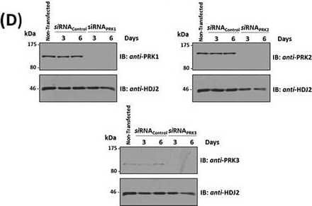 Western Blot: PKN3 Antibody [NBP1-30102] - Effect of siRNA-mediated disruption of PRK1, PRK2 & PRK3 expression on TP agonist-induced proliferation & migration of PC-3 cellsPanels A-D. PC-3 cells were transfected for 48 hr with 30 nM siRNAPRK1, siRNAPRK2, siRNAPRK3 or, as controls, with a scrambled siRNA (siRNAControl) prior to stimulation with U46619 (10 nM) or vehicle (0.0001% EtOH) for the indicated time specific to the assay, where non-transfected cells served as a reference. Panel A: For analysis of proliferation, 72 hr post-siRNA transfection PC-3 cells were stimulated for 48 hr with U46619 (10 nM) or vehicle (0.0001% EtOH). Panel B: For analysis of colony formation, 48 hr post-siRNA transfection PC-3 cells were stimulated with U46619 (10 nM) or vehicle (0.0001% EtOH) in soft agar & assessed 10 day post-treatment for colony formation. Panel C: For analysis of migration, 72 hr post-siRNA transfection PC-3 cells were stimulated for 8 hr with U46619 (10 nM) or vehicle (0.0001% EtOH). In Panels A-C, the bar charts show mean relative levels of PC-3 cell proliferation, colony formation & migration (± SEM, n ≥ 3), where levels in the vehicle-treated cells are assigned a value of 100%. The asterisks indicate where U46619-stimulation resulted in significant increases in proliferation, colony formation or migration by PC-3 cells compared to vehicle-treated cells, where ** & *** indicates p < 0.01 & p < 0.001, respectively. Panel D: Validation of the specificity & sustained siRNA-mediated disruption of PRK1, PRK2 & PRK3 expression was confirmed by immunoblot analysis of whole cell lysates (20 μg/lane) with the respective anti-PRK1/2/3 or, to validate protein loading, with anti-HDJ2 antisera where analysis was carried out 3 & 6 day post-transfection. Data n ≥ 3. Image collected & cropped by CiteAb from the following publication (//www.oncotarget.com/lookup/doi/10.18632/oncotarget.4664), licensed under a CC-BY license. Not internally tested by Novus Biologicals.