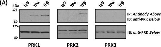 Western Blot: PKN3 Antibody [NBP1-30102] - Association of PRK1 & PRK2 with TP alpha  & TP beta  in prostate PC-3 cellsPanel A. PC-3 cells were immunoprecipitated with anti-TP alpha , anti-TP beta  or, as controls, with the pre-immune (IgG) sera. Thereafter, immunoprecipitates (upper panels) or equivalent aliquots of whole cell lysates (20 μg/lane, lower panels) were immunoblotted (IB) with anti-PRK1, anti-PRK2 or anti-PRK3 antisera. The relative positions of the molecular size markers (kDa) are indicated to the left of the panels. Data shown are representative of at least three independent experiments (n ≥ 3). Panel B. PC-3 cells were incubated with U46619 (1 μM; 0–60 min) prior to immunoprecipitation with anti-TP alpha , anti-TP beta  or, as controls, with the pre-immune (IgG) sera. Thereafter, immunoprecipitates (upper panels) or equivalent aliquots of whole cell lysates (20 μg/lane, lower panels) were IB with anti-PRK1, anti-PRK2 or anti-PRK3 antisera. Data n ≥ 3. Panel C. Bar charts show the mean relative levels of PRK1 or PRK2 associated with the anti-TP alpha  or anti-TP beta  immunoprecipitates, as determined by quantitative densitometry (± SEM), where levels associated with the respective immunoprecipitates in the absence of agonist are expressed as 1. The asterisks indicate where U46619 stimulation resulted in significant changes in complex-associated PRK1 or PRK2, where * & ** indicate p < 0.05 & p < 0.01, respectively. Image collected & cropped by CiteAb from the following publication (//www.oncotarget.com/lookup/doi/10.18632/oncotarget.4664), licensed under a CC-BY license. Not internally tested by Novus Biologicals.