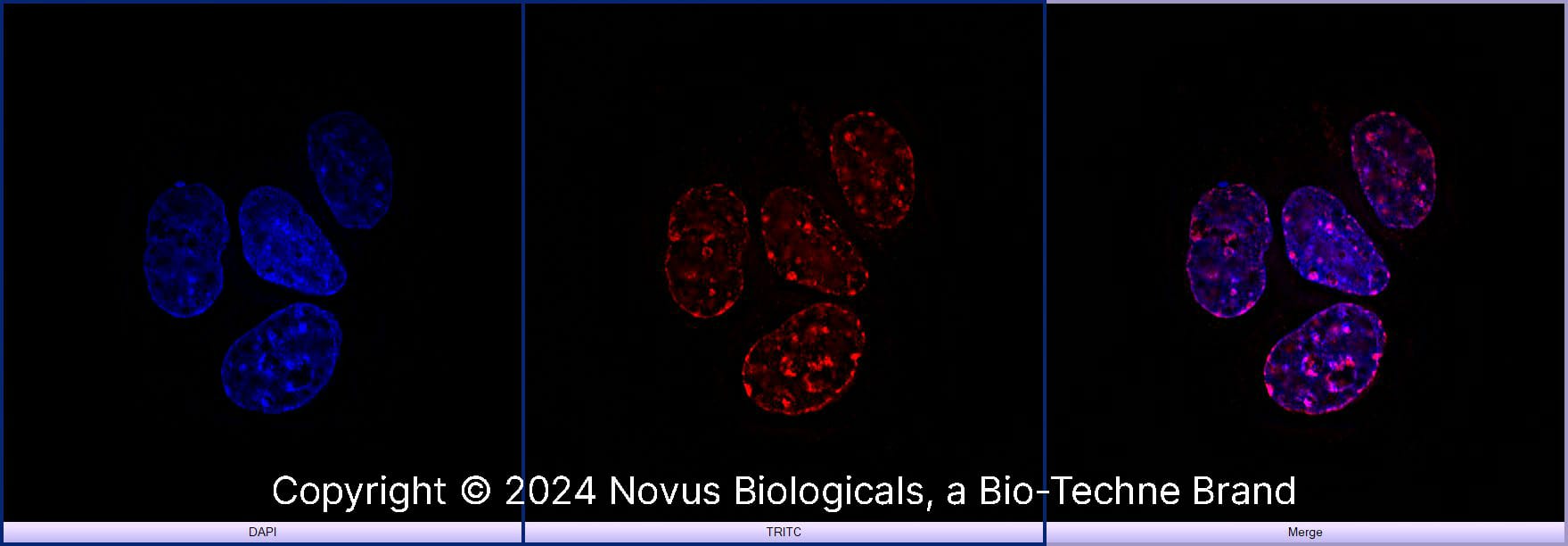 Histone H3 [Trimethyl Lys9] (6F12-H4) was detected in immersion fixed MCF7 human breast cancer cell line using Mouse anti- Histone H3 [Trimethyl Lys9] (6F12-H4) Protein G Purified Monoclonal Antibody conjugated to DyLight 550 (Catalog # NBP1-30141R) (red) at 5 µg/mL overnight at 4C. Cells were counterstained with DAPI (blue). Cells were imaged using a 100X objective and digitally deconvolved. 