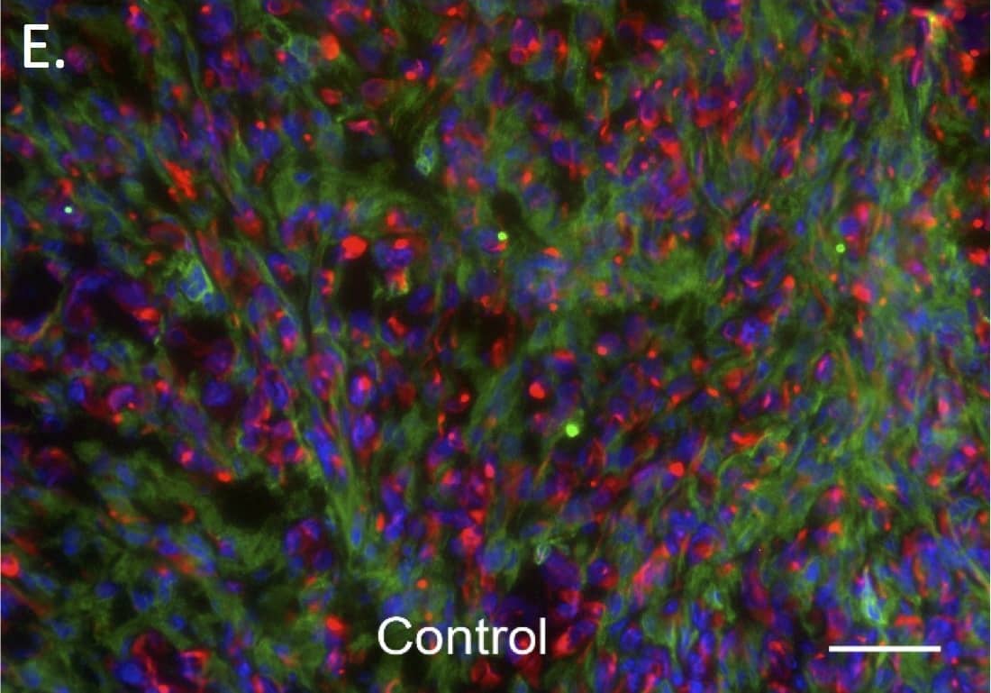 Immunocytochemistry/ Immunofluorescence: Cytokeratin 7 Antibody (R17-S) [NBP1-30152] - Collagen type I.The total amount of collagen type I quantified as percent of total area in both control (n = 5 tumors) & HBOT (n = 5 tumors) primary tumors (A) is shown. The total amount of ITGB1 as percent of total area in both control (n = 5 tumors) & HBOT (n = 5 tumors) primary tumors (B). A representative immunofluorescence (IF) staining picture from a control (C) & HBOT (D) tumor is shown. Green represents stroma cells (stained with antibody to mouse integrin-beta 1) red represents collagen type I secreted by the stromal cells (stained with antibody to mouse collagen type I), & blue shows the nuclei stained with DAPI. Scale bar represents 100 μm. Representative IF pictures are also shown to illustrate the compostion/proportion of the tumor cells (red, stained with cytokeratin 7 antibody) & the stromal cells (green, stained with integrin  beta 1 antibody) from the control (E) & and HBOT (F) tumors, respectively. Scale bar represents 100 μm. Image collected & cropped by CiteAb from the following publication (//pubmed.ncbi.nlm.nih.gov/28832662), licensed under a CC-BY license. Not internally tested by Novus Biologicals.