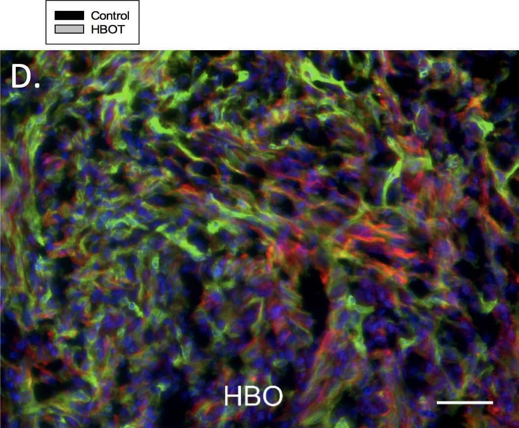 Western Blot: Cytokeratin 7 Antibody (R17-S) [NBP1-30152] - Collagen type I.The total amount of collagen type I quantified as percent of total area in both control (n = 5 tumors) & HBOT (n = 5 tumors) primary tumors (A) is shown. The total amount of ITGB1 as percent of total area in both control (n = 5 tumors) & HBOT (n = 5 tumors) primary tumors (B). A representative immunofluorescence (IF) staining picture from a control (C) & HBOT (D) tumor is shown. Green represents stroma cells (stained with antibody to mouse integrin-beta 1) red represents collagen type I secreted by the stromal cells (stained with antibody to mouse collagen type I), & blue shows the nuclei stained with DAPI. Scale bar represents 100 μm. Representative IF pictures are also shown to illustrate the compostion/proportion of the tumor cells (red, stained with cytokeratin 7 antibody) & the stromal cells (green, stained with integrin  beta 1 antibody) from the control (E) & and HBOT (F) tumors, respectively. Scale bar represents 100 μm. Image collected & cropped by CiteAb from the following publication (//pubmed.ncbi.nlm.nih.gov/28832662), licensed under a CC-BY license. Not internally tested by Novus Biologicals.