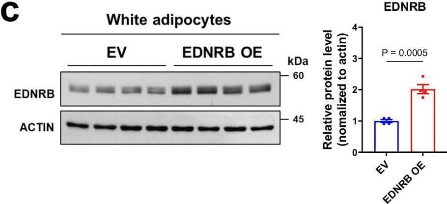 EDNRB overexpression promotes thermogenic differentiation of human white adipocytes in vitro.a Schematic of EDNRB gene activation using CRISPR-SAM system. b–g Human white preadipocytes were transfected with the CRISPR-SAM system and either empty vector (EV) or sgRNA#3 targeting EDNRB (EDNRB OE) and were differentiated to mature adipocytes. b Relative EDNRB and EDNRA mRNA levels in human white adipocytes. n = 3 biological replicates/group. c Relative EDNRB protein levels in human white adipocytes. n = 4 biological replicates/group. d Relative mRNA expressions in adipogenic and thermogenic genes in human white adipocytes. n = 3 biological replicates/group. e Fatty acid-dependent oxygen consumption rate (OCR) in human white adipocytes. Quantification of maximal OCR in the right panel. EV: n = 3, EDNRB OE: n = 4, EV-ETO: n = 4, EDNRB OE-ETO: n = 3 biological replicates. Pal, palmitate-BSA. OA, oligomycin A. AA, antimycin A. ETO, etomoxir. f Forskolin (FSK)-stimulated OCR in human white adipocytes. n = 5 biological replicates/group. g Thermogenesis capacity monitored by ERthermAC dye in human white adipocytes. Area above the curve (AAC) of thermogenesis in the right panel. EV: n = 21 cells, EDNRB OE: n = 22 cells. Data are presented as mean +/- SEM. P values were determined using unpaired two-tailed t tests: (b–g). Source data are provided as a Source Data file. Panel (a) was created with BioRender.com released under a Creative Commons Attribution-NonCommercial-NoDerivs 4.0 International license. Image collected and cropped by CiteAb from the following open publication (//pubmed.ncbi.nlm.nih.gov/39174539), licensed under a CC-BY license. Not internally tested by Novus Biologicals.