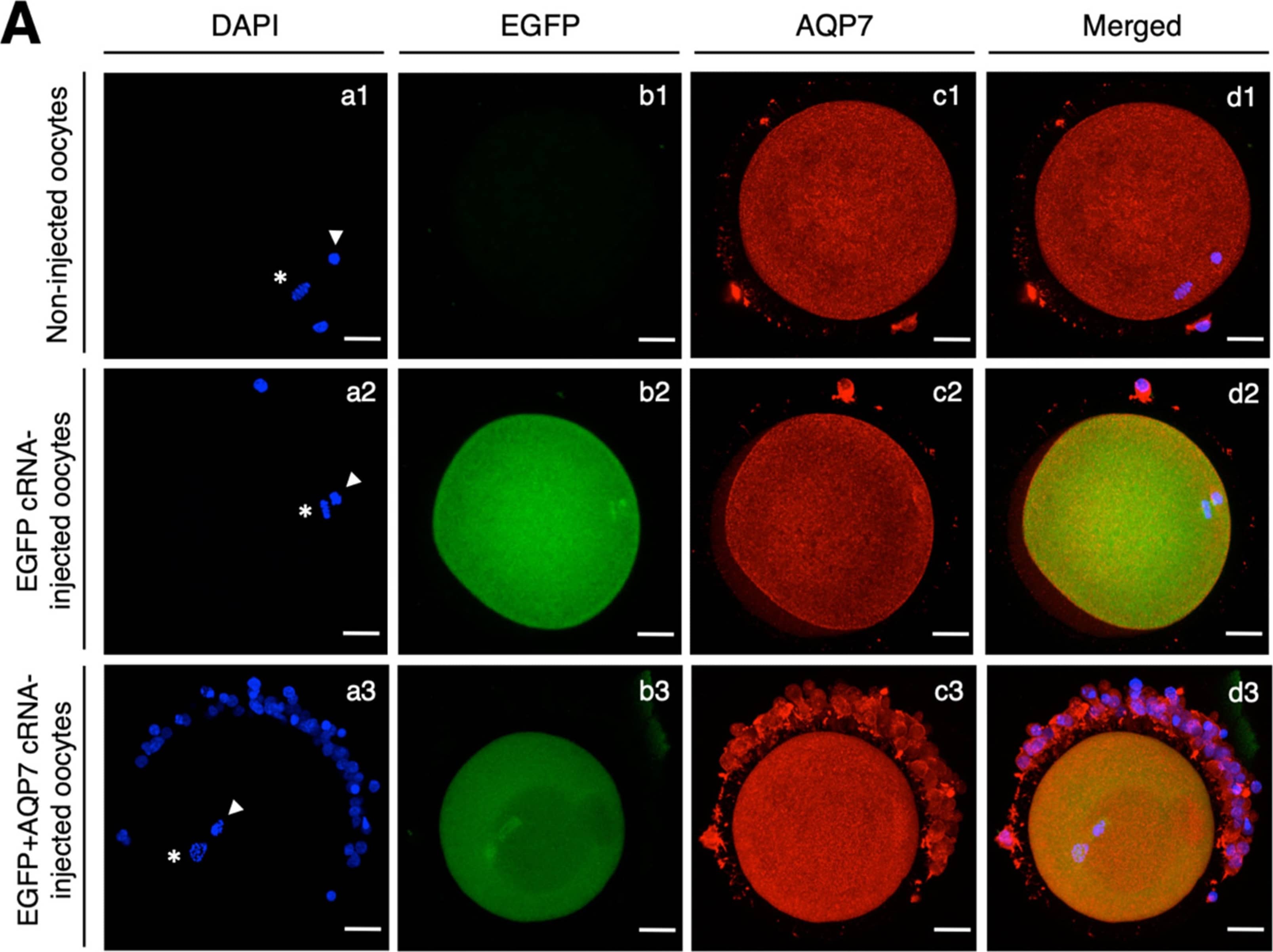 Immunocytochemistry/ Immunofluorescence Aquaporin-7 Antibody