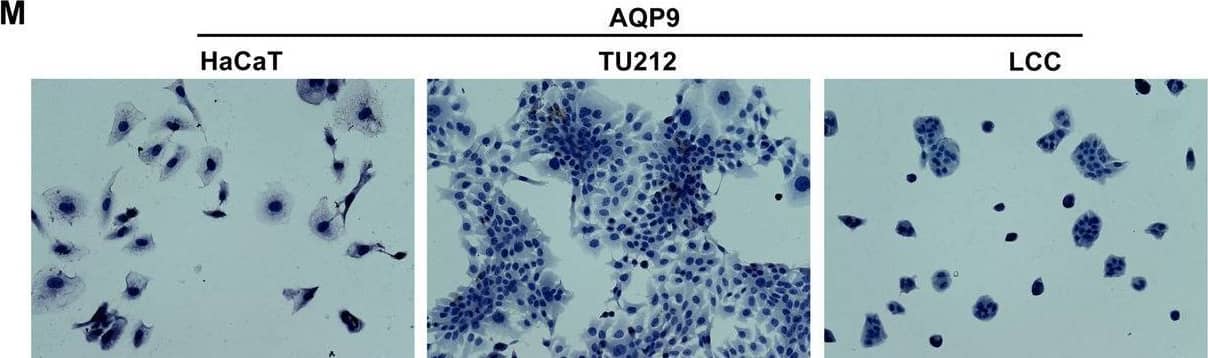 Immunohistochemistry Aquaporin-9 Antibody