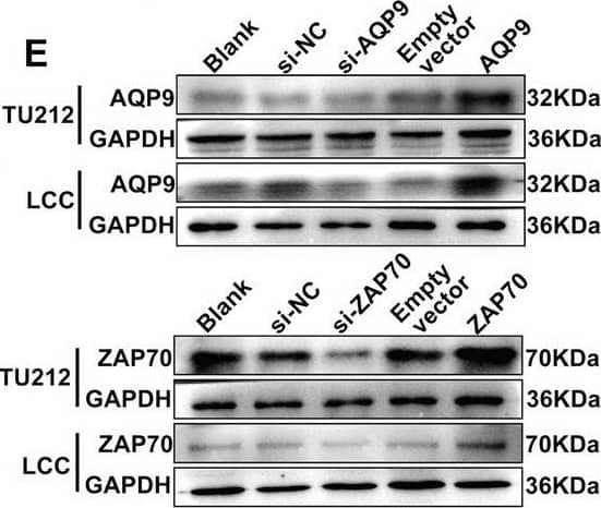 Western Blot Aquaporin-9 Antibody