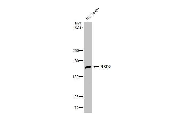 Whole cell extract (30 ug) was separated by 5% SDS-PAGE, and the membrane was blotted with WHSC1 antibody [N1], N-term (NBP1-30910) diluted at 1:1000. The HRP-conjugated anti-rabbit IgG antibody was used to detect the primary antibody. 