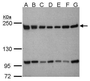 Western Blot BTAF1 Antibody