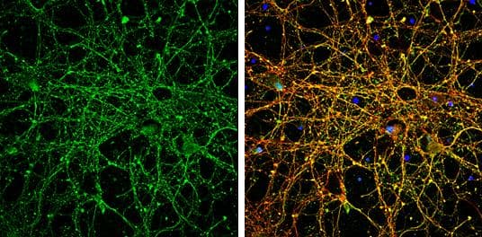 EEA1 antibody [C3], C-term detects EEA1 protein by immunofluorescent analysis.Sample: DIV9 rat E18 primary cortical neurons were fixed in 4% paraformaldehyde at RT for 15 min.Green: EEA1 protein stained by EEA1 antibody [C3], C-term (NBP1-30914) diluted at 1:500.Red: beta Tubulin 3/ Tuj1, stained by beta Tubulin 3/ Tuj1 antibody [GT886] diluted at 1:500.Blue: Fluoroshield with DAPI . 