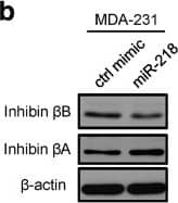 Western Blot: Activin A Antibody [NBP1-30928] - miR-218 directly targets INHBB & YY1, & increases INHBA expression. a Relative RNA level of INHBB & INHBA normalized to 18S in MDA-231 transfected with miR-218 or control miRNA mimic at 24 h & 72 h, respectively. ***P < 0.001. b Western blot analyses of inhibin  beta B & inhibin  beta A in mimic-transfected MDA-231 cells at 48 h. c Relative RNA level of INHBB & INHBA normalized to 18S in MDA-231-bone transfected with anti-miR-218 or control antagomiR at 24 h & 48 h, respectively.. **P < 0.01; ***P < 0.001. d Sequence alignment of miR-218 & its predicted targets INHBB & YY1. e psiCheck2 reporter plasmids & miR-218 mimic or its corresponding control were transfected into indicated cell lines. Renilla & firefly luciferase activity was measured at 48 h. *P < 0.05; n.s. not significant. f Relative RNA level of YY1 normalized to 18S in mimic-transfected MDA-231 cells at 24 h. ***P < 0.001. g Western blot analyses of YY1 & inhibin  beta A in MDA-231 cells co-transfected with miR-218 mimic & YY1-overexpressing plasmid, or the corresponding controls at 72 h. h psiCheck2 reporter plasmids & miR-218 mimic or its corresponding control vector were transfected into MDA-231 cells. Renilla & firefly luciferase activity was measured at 48 h. **P < 0.01; n.s. not significant Image collected & cropped by CiteAb from the following publication (//pubmed.ncbi.nlm.nih.gov/30348200), licensed under a CC-BY license. Not internally tested by Novus Biologicals.