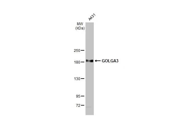 Western Blot: GOLGA3 Antibody [NBP1-30963] - Whole cell extract (30 ug) was separated by 5% SDS-PAGE, and the membrane was blotted with GOLGA3 antibody [C3], C-term (NBP1-30963) diluted at 1:1000. The HRP-conjugated anti-rabbit IgG antibody  was used to detect the primary antibody, and the signal was developed with Trident ECL plus-Enhanced.
