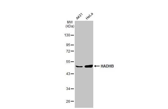 Western Blot: HADHB Antibody [NBP1-30965] - Various whole cell extracts (30 ug) were separated by 10% SDS-PAGE, and the membrane was blotted with HADHB antibody [N1], N-term (NBP1-30965) diluted at 1:1000. The HRP-conjugated anti-rabbit IgG antibody  was used to detect the primary antibody.