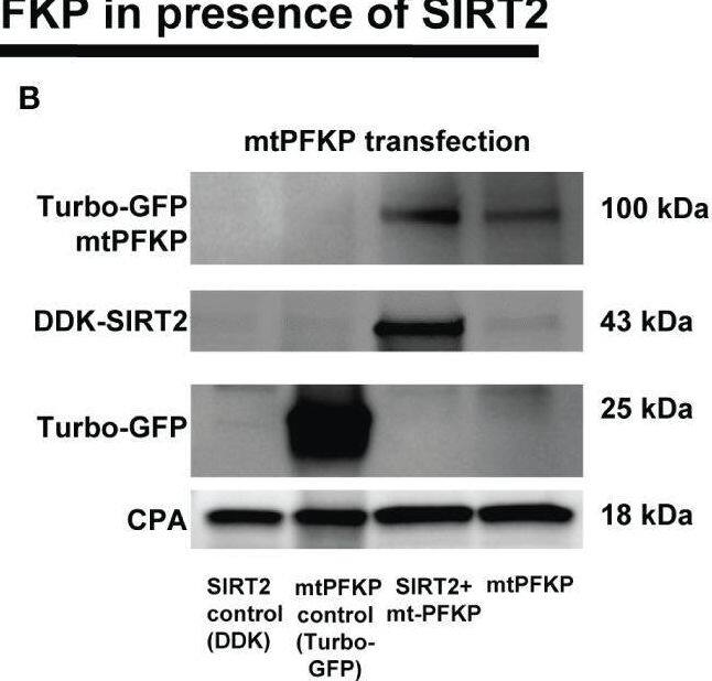 Effect of K394R mutation on PFKP. (A, B) HEK293T cells transfected with wtPFKP/mtPFKP in the presence or absence of SIRT2. Western blot analysis of Turbo-GFP-wtPFKP, DDK-SIRT2, turbo-GFP (control for wtPFKP plasmid transfected) and CPA. (C) mtPFKP transfection and IP using turbo-GFP-trap in HEK293T cells, in presence or absence of SIRT2 followed by IB analysis of acetyl lysine, turbo-GFP-mtPFKP and turbo-GFP (control for wtPFKP plasmid transfected). Pulldown with HEK293T cell lysate without transfection was used as a negative control. (D) Western blot analysis of turbo-GFP mtPFKP, DDK-SIRT2, turbo-GFP and CPA in whole cell lysate, used as an input for the turbo-GFP IP. (E) mtPFKP transfection and IP using magnetic-TUBEs in HEK293T cells, in presence or absence of SIRT2 followed by IB analysis of ubiquitination. (F) Western blot analysis of turbo-GFP mtPFKP, DDK-SIRT2, turbo-GFP and CPA in whole cell lysate used as input for the TUBE IP. Image collected and cropped by CiteAb from the following open publication (//pubmed.ncbi.nlm.nih.gov/36865524), licensed under a CC-BY license. Not internally tested by Novus Biologicals.